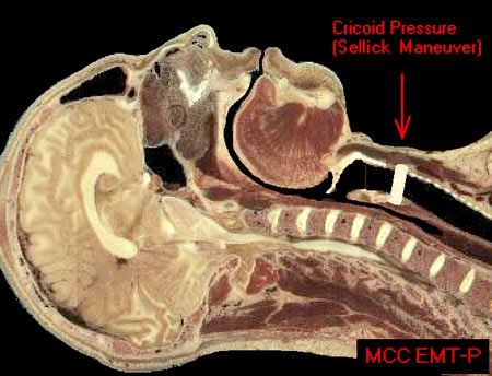 Photo of cross section of human head