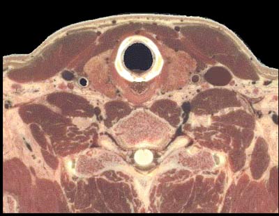 Photo of cartilage cross section