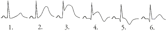 Image of ekg strip