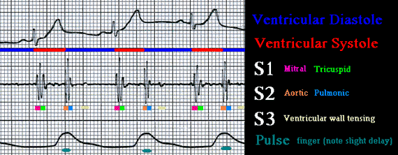 Image of ekg graph