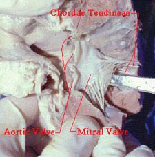 Photos of dissected heart showing valve locations