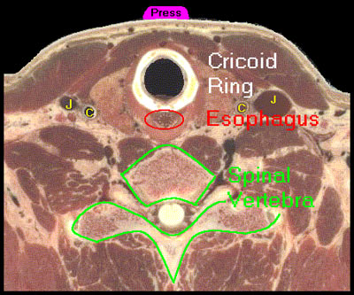 Photo of cartilage cross section