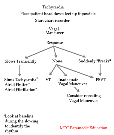 flow chart for vagal maneuvers